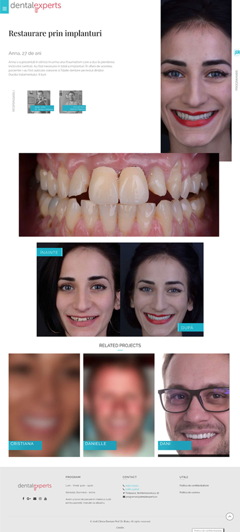 prezentare site dentalexperts
